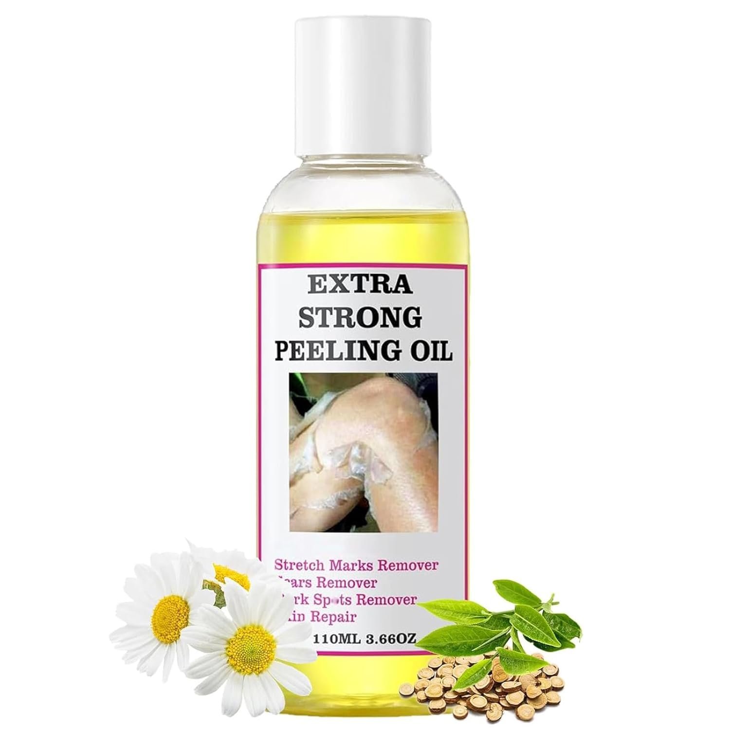 Yellow Peeling Oil For Dark Skin – Natural Formula Exfoliating Peels Solution, Exfoliating Peeling Solution For Body, Hand, Feet And Face All Skin Type